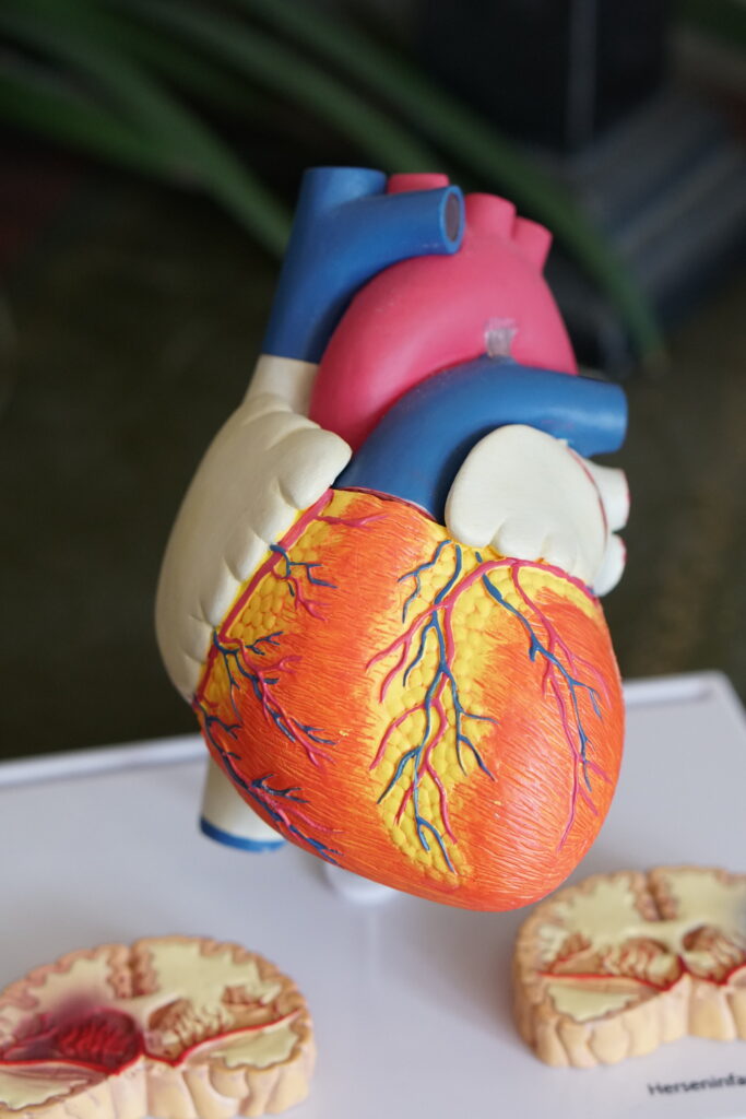 Heart Disease and Stroke Statistics