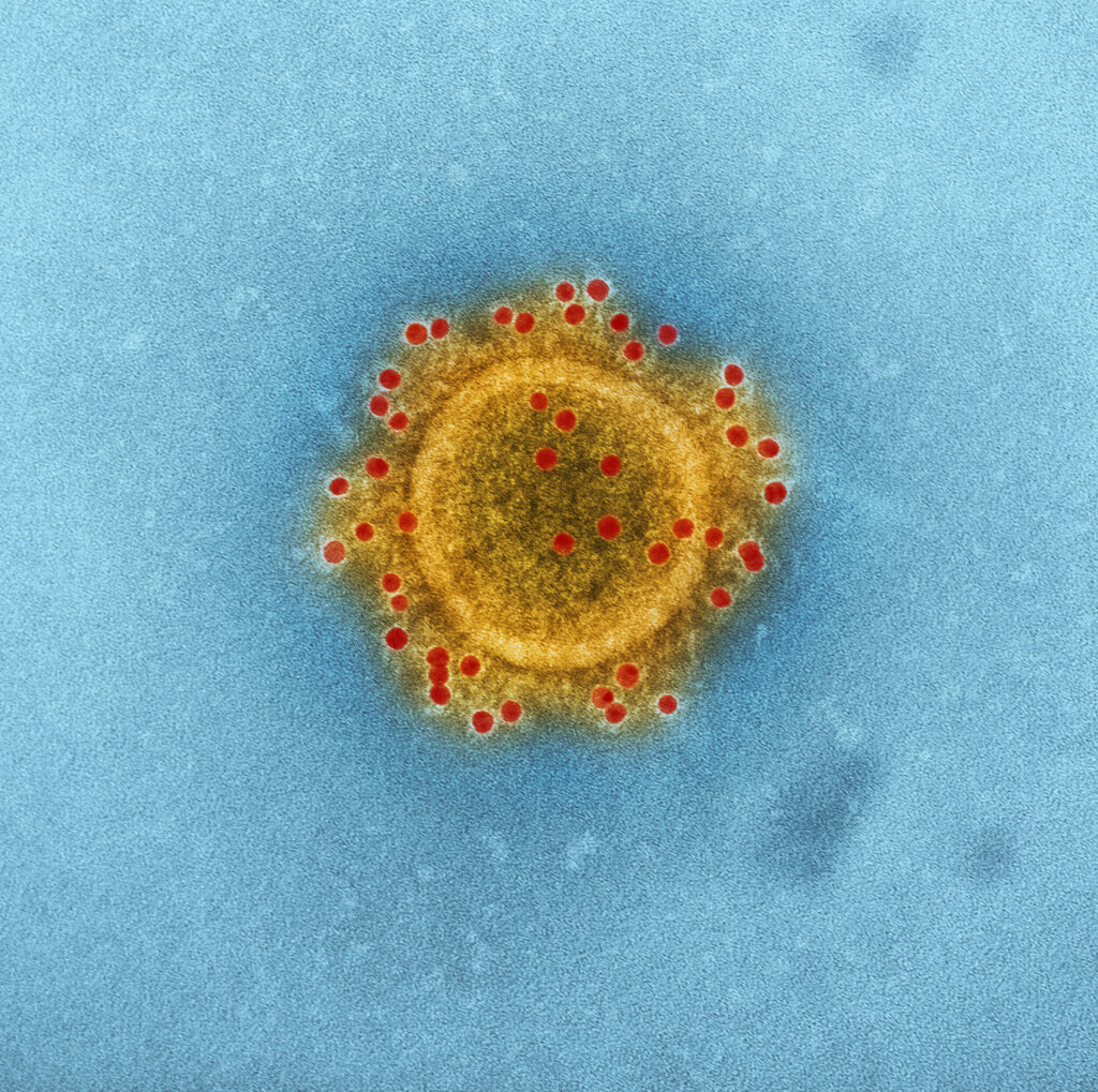 Coronavirus: How to Prevent Being Exposed.