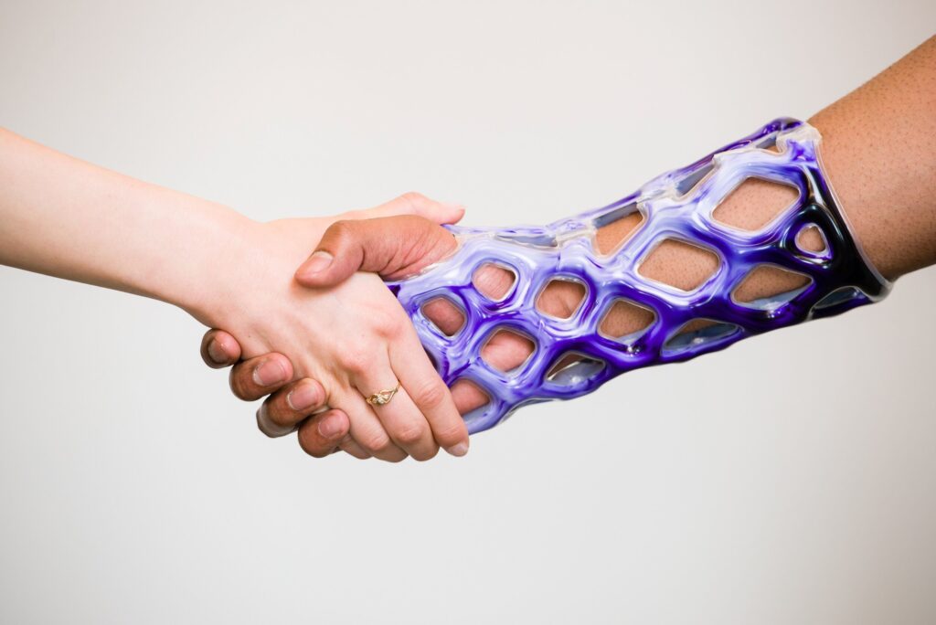 Cast 21: Mesh Sleeve That Can Replace Traditional Casts