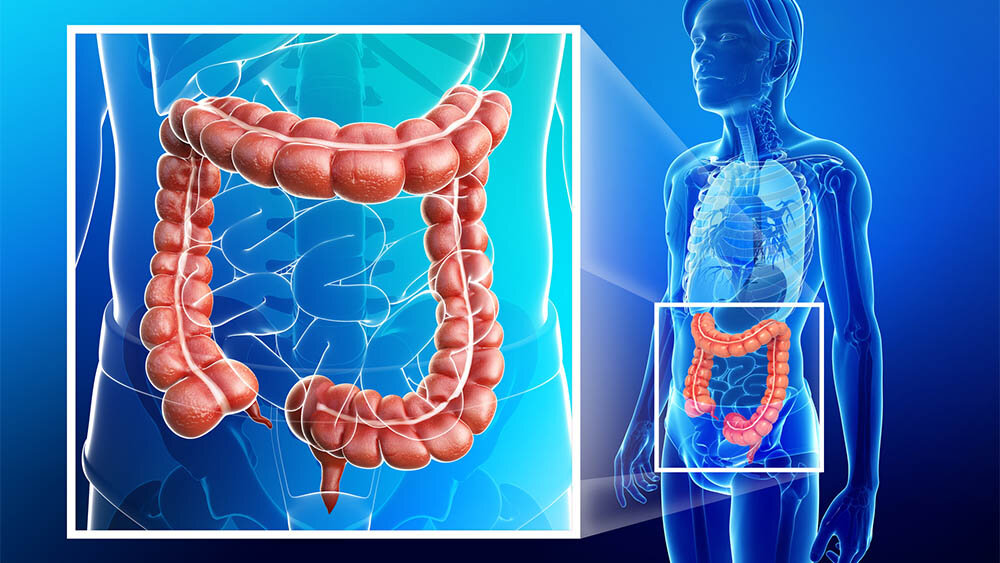 6 Ways to Help Lower Your Risk For Colorectal Cancer