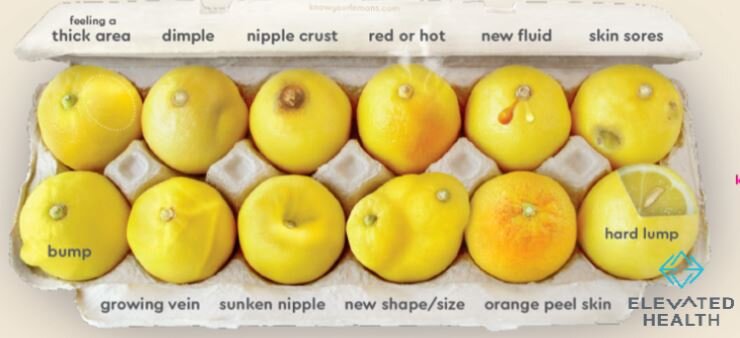 A cancerous lump usually feels hard and immovable like a lemon seed. It can be any shape or size.