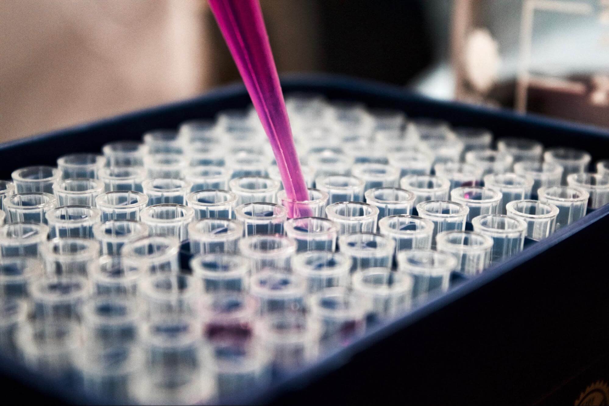 Refilling medical test tubes with pink liquid testing for antibody treatment
