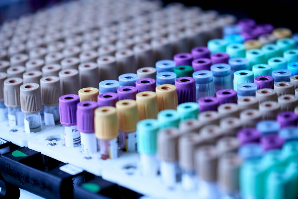 What a Complete Metabolic Panel Can Reveal to You